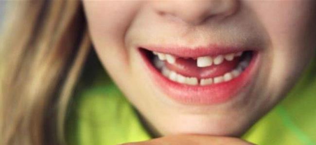  لماذا يجب على الأهل الإحتفاظ بأسنان أطفالهم بعد سقوطها؟