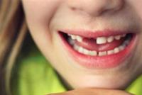  لماذا يجب على الأهل الإحتفاظ بأسنان أطفالهم بعد سقوطها؟