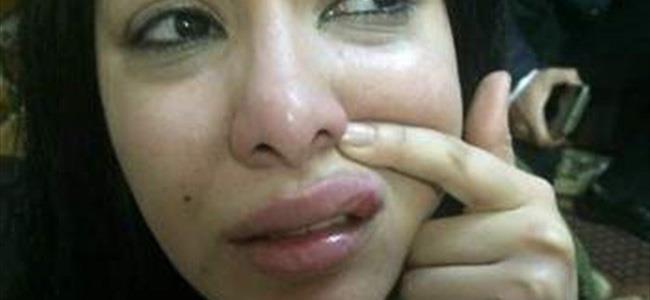  توقيف وضرب نجمة ستار اكاديمي.. هل تم التحرّش بها؟