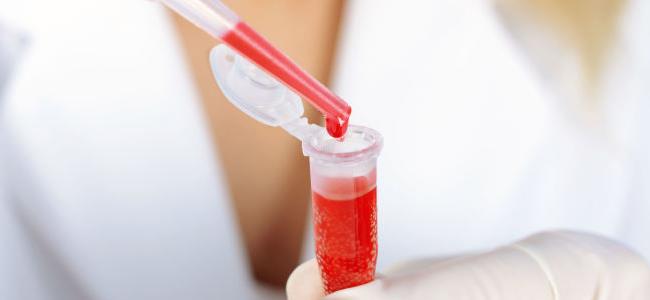 طريقة جديدة لمعرفة فصيلة الدم في 30 ثانية
