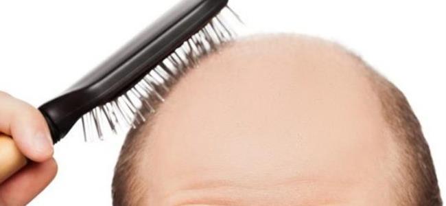 هل للقامة ولون البشرة علاقة بفقدان الشعر؟