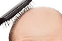 هل للقامة ولون البشرة علاقة بفقدان الشعر؟